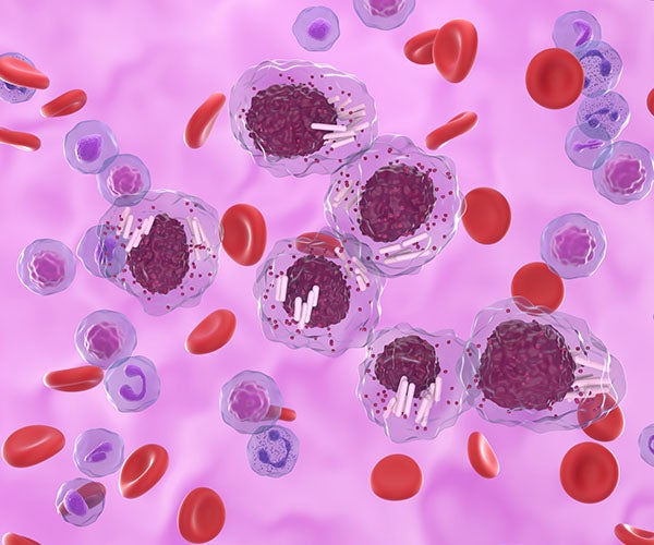 Chronic Lymphocytic Leukemia thumbnail