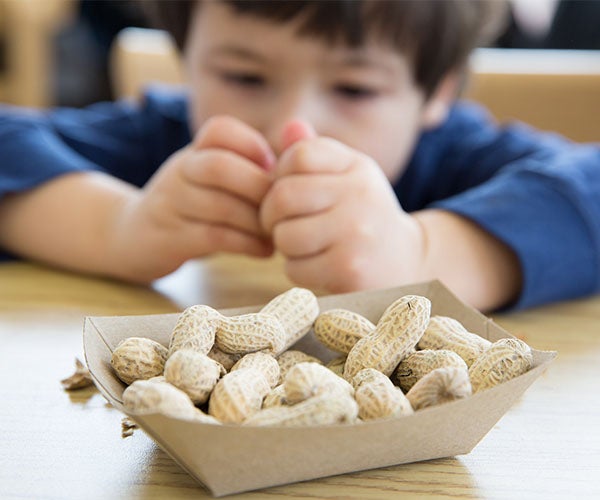 Food allergies thumbnail