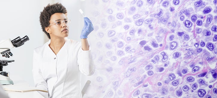 Lymphoma Disease State Resources