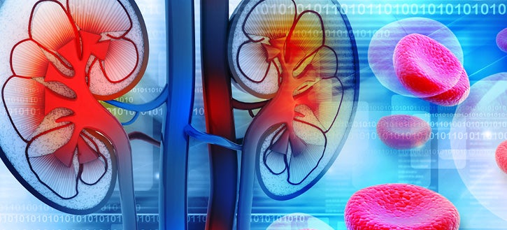 CKD Disease State Banner