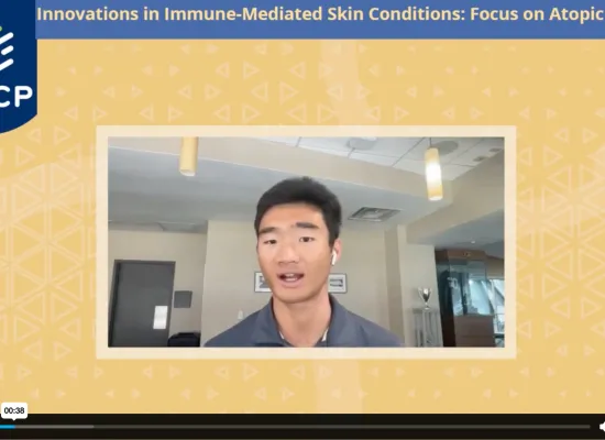 Jeremy’s Patient Story: Atopic Dermatitis (Eczema)