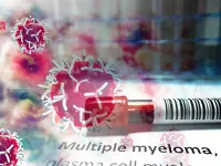 Multiple Myeloma